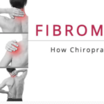 Fibromyalgia