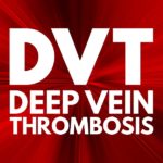 DVT Blood clot west florida vein center