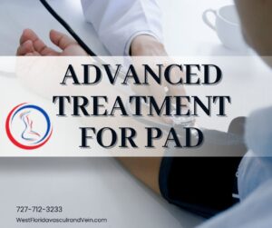 PAD Treatments safety Harbor and Tampa Florida